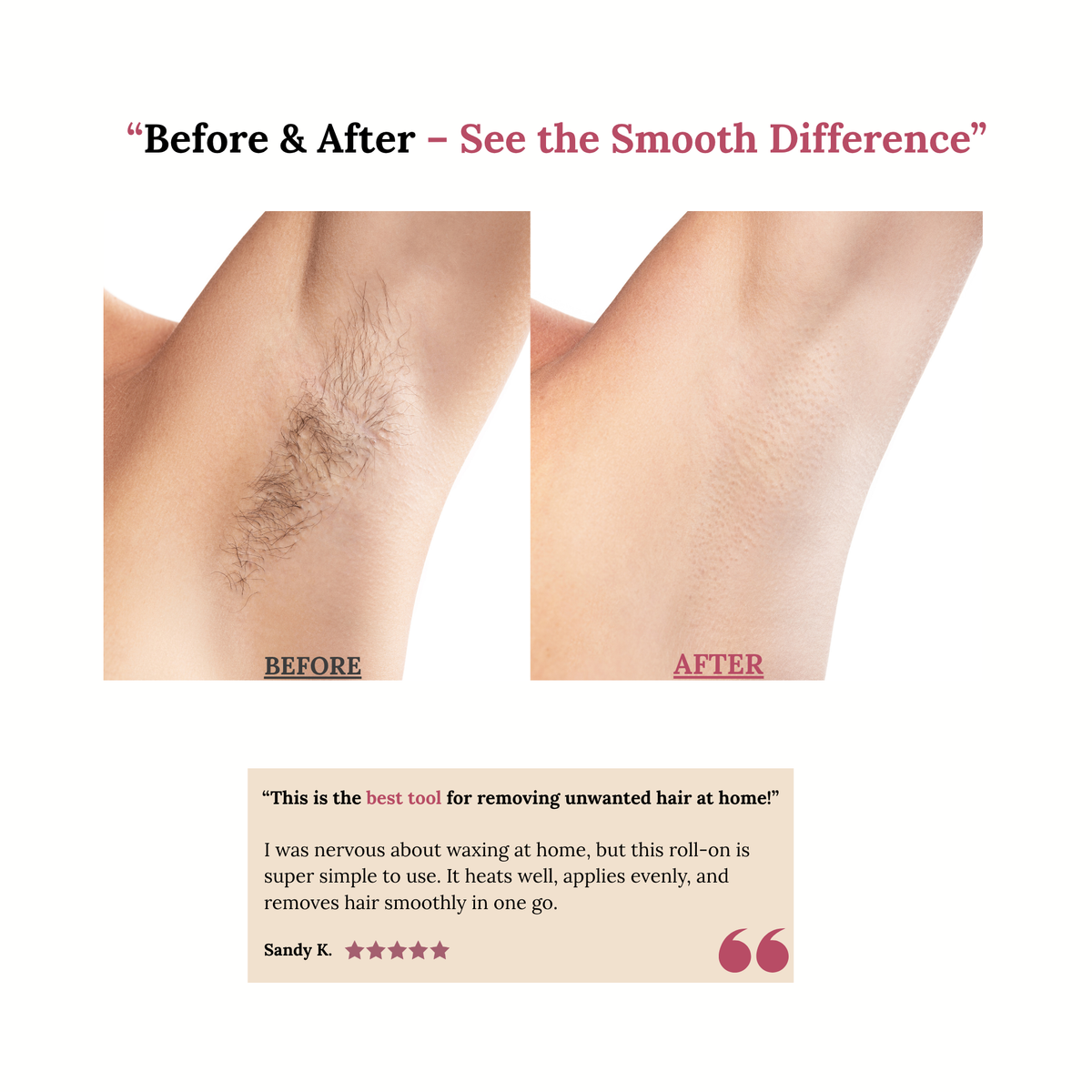 Roll-On Wax Kit – Smooth, Salon-Quality Hair Removal at Home