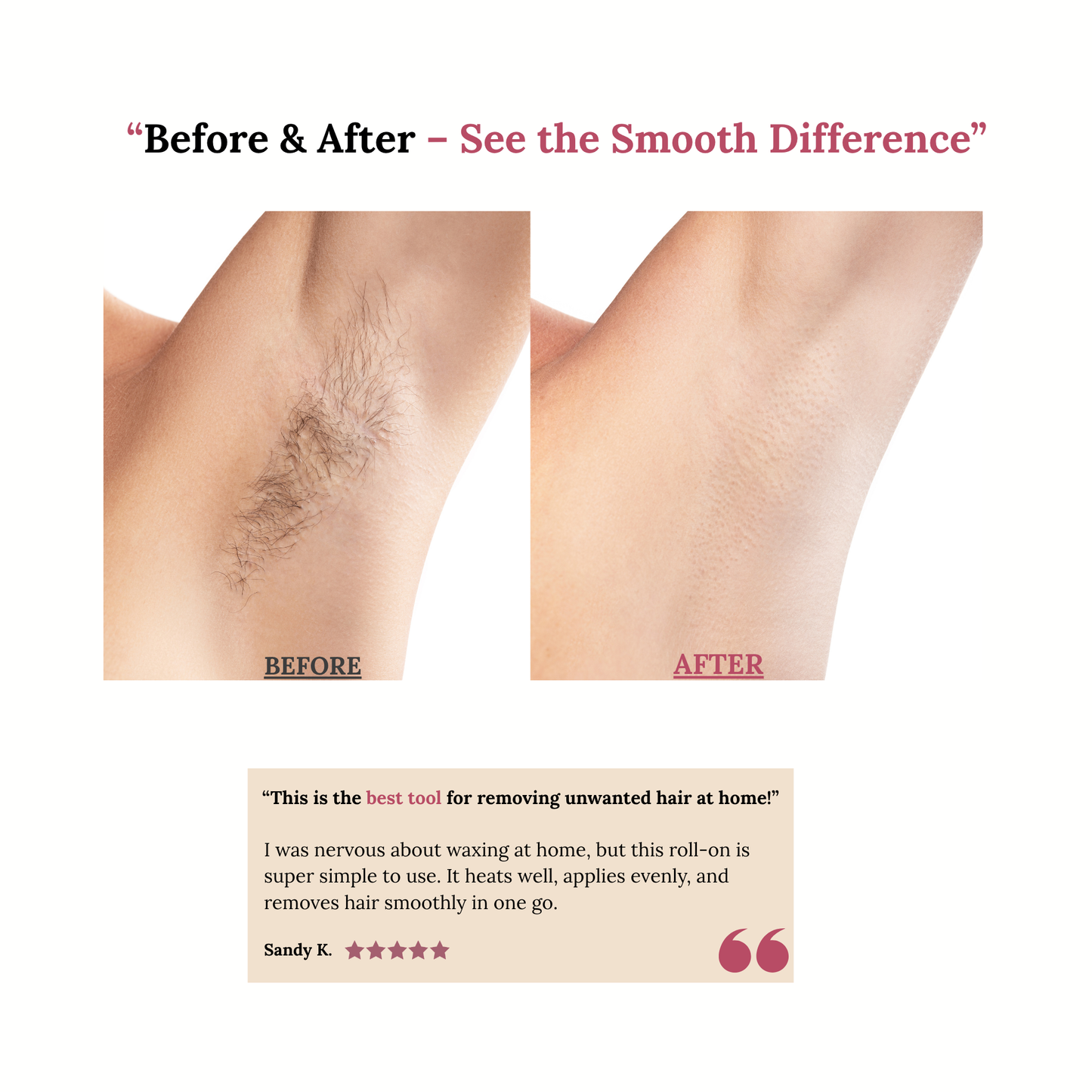 Roll-On Wax Kit – Smooth, Salon-Quality Hair Removal at Home